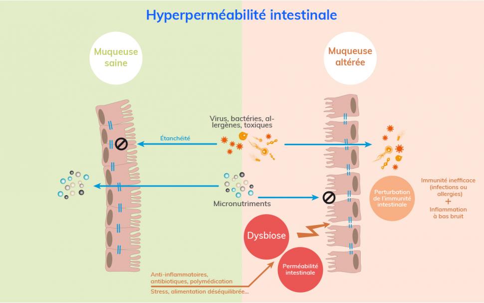 L’hyperperméabilité intestinale laisse passer des substances nuisibles à travers la muqueuse et altère le bon fonctionnement du système immunitaire