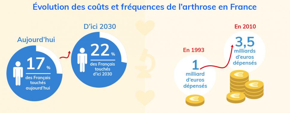 : La fréquence de l’arthrose et le coût de prise en charge des patients sont en augmentation