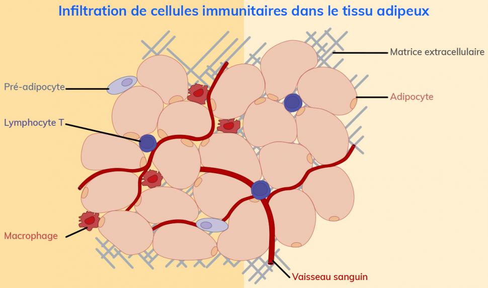 Des macrophages, cellules inflammatoires, au sein du tissu adipeux